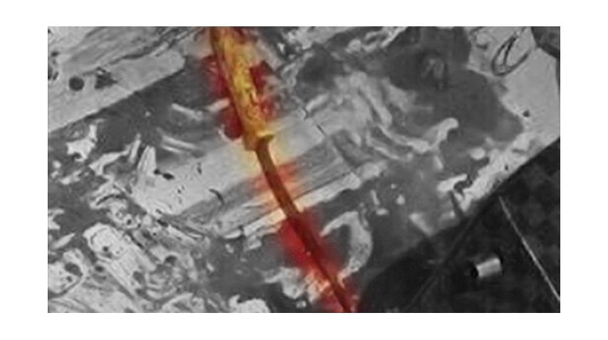 La foto fue retocada para no herir la susceptibilidad del lector.