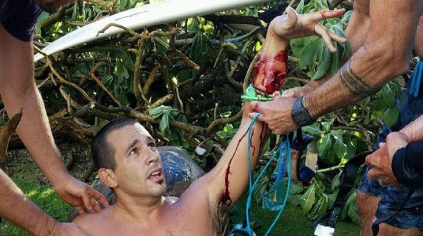 Argentino atacado por un tiburón en Hawái