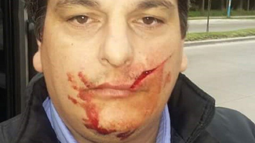 Colectivero de la línea 203 agredido con un machete (imagen sin censurar)