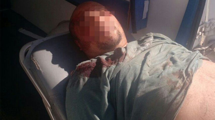 Fotos del tiroteo en el que cayó la Banda del Millón