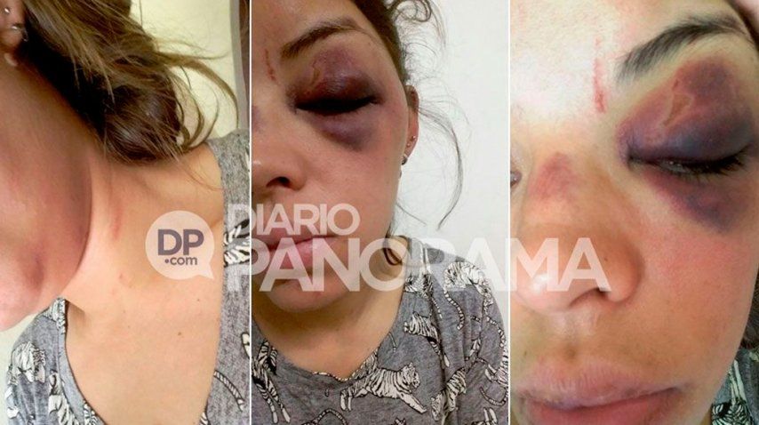 Florencia González de 28 años fue salvajemente golpeada por su ex.