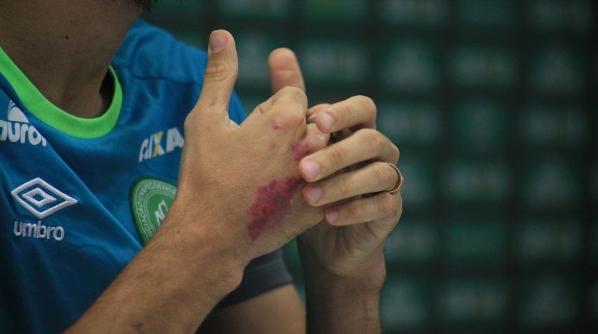 Las manos aún heridas de Hélio Zampier Neto