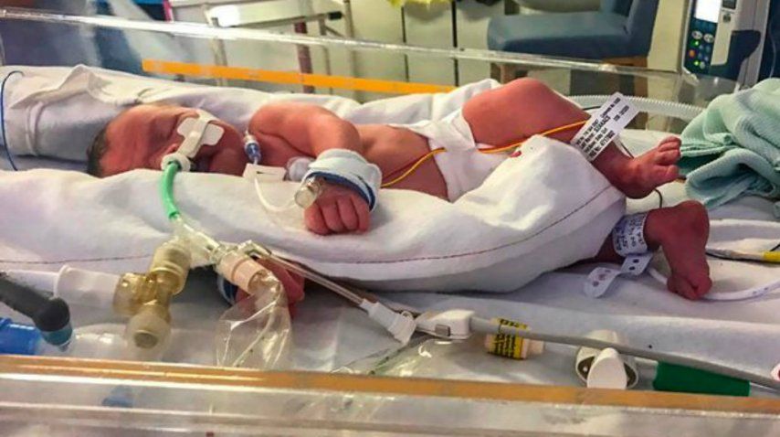 Evlyn nació con severas complicaciones<br>