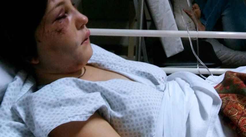 Tiene golpes en la cara y en la espalda. Todavia no puede escuchar de un oído<br>