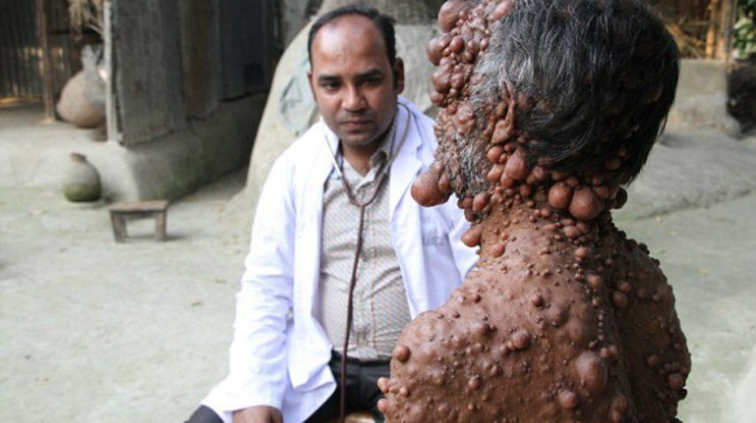 Hossain ya no puede salir a la calle de la vergüenza<br>