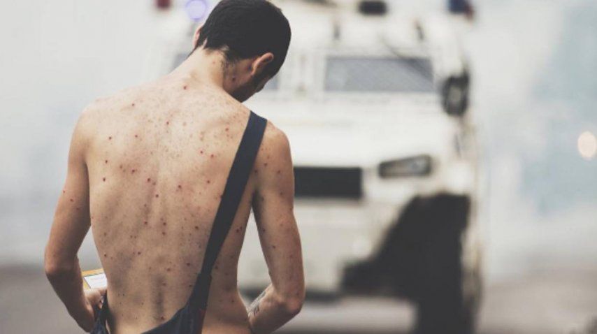 Manifestante desnudo en una autopista de Caracas se viralizó<br>