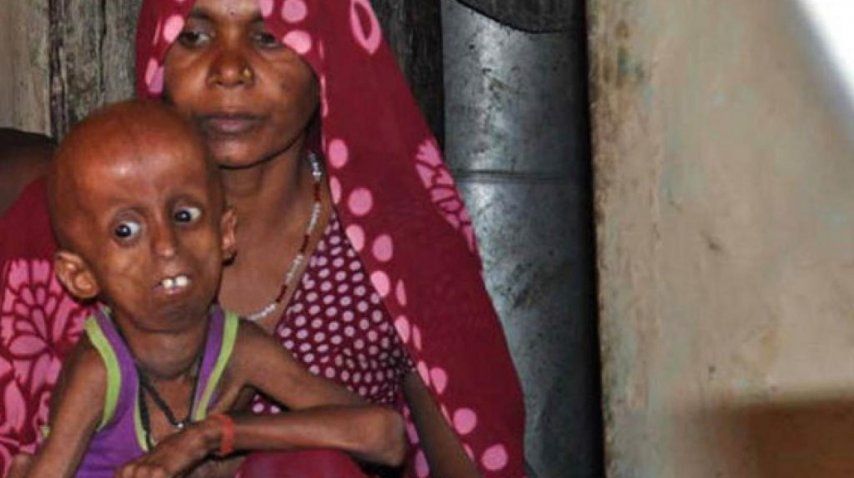 El drama del joven Rupesh