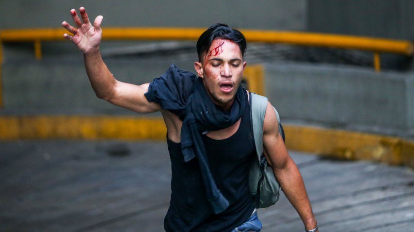 Un joven resultó herido en las protestas contra el gobierno de Nicolás Maduro<br>