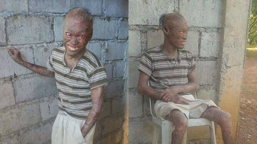 El joven dejó de ir a la escuela, el mercado y las reunines sociales<br>