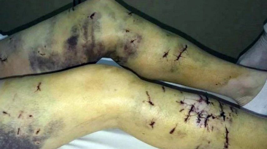 Una jauría atacó a una mujer en Ushuaia - Crédito: TN