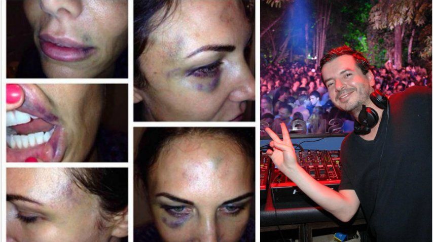 Abigail Blake y Betoko, el DJ que está condenado por golpeador de mujeres<br>